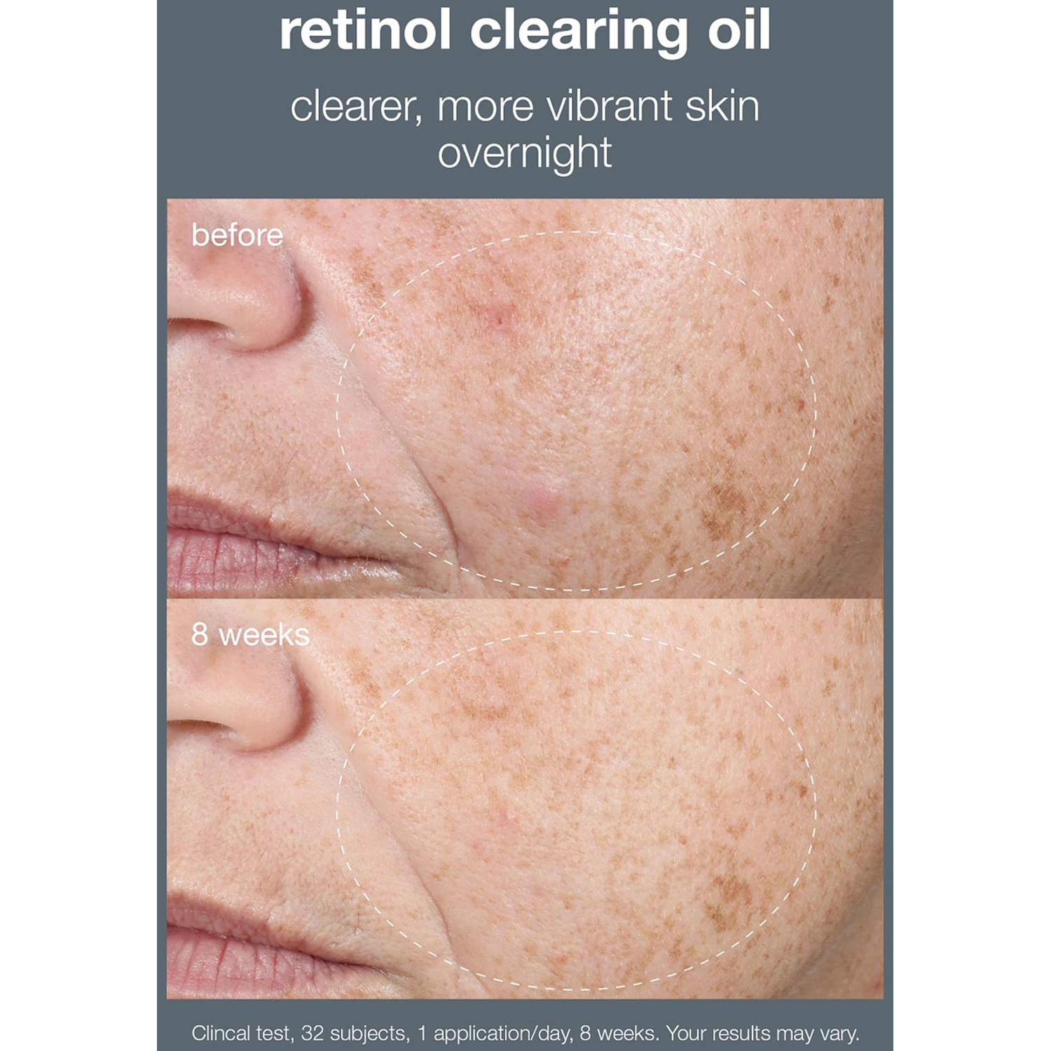 Retinol Clearing oil