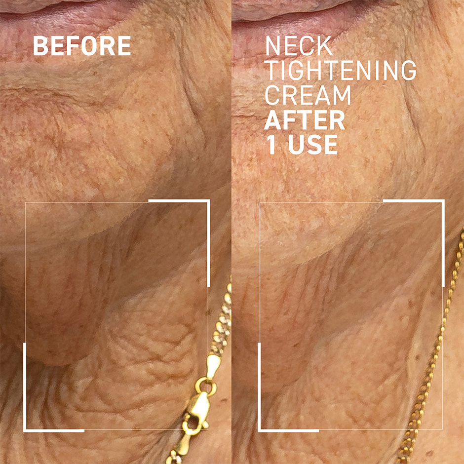 Neck Tightening Cream