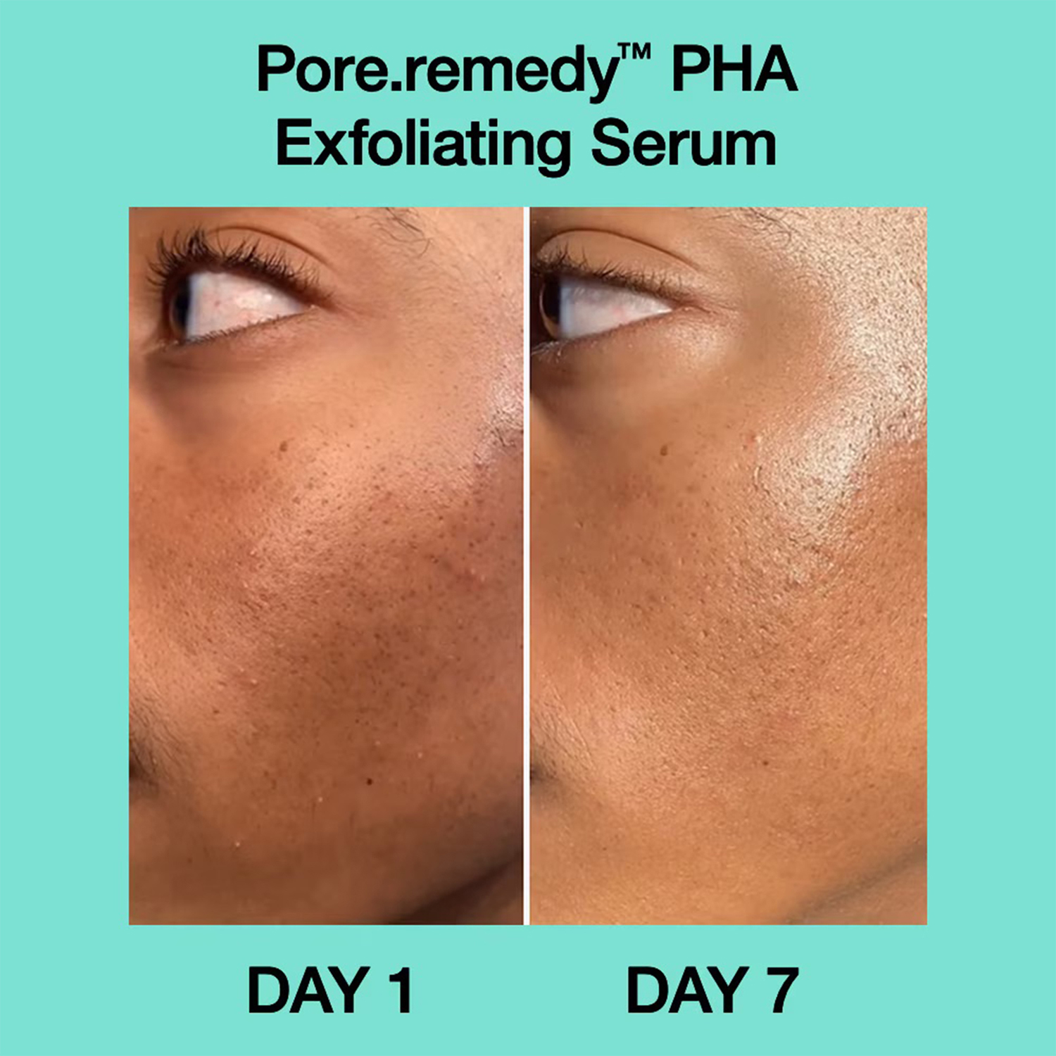 Pore-remedy PHA Exfoliating Serum